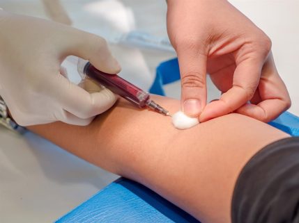 phlebotomy-1024x768